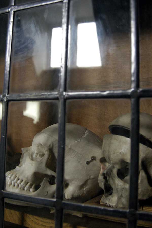 Hospital cabinet with human skulls. Whitechapel, London 2002